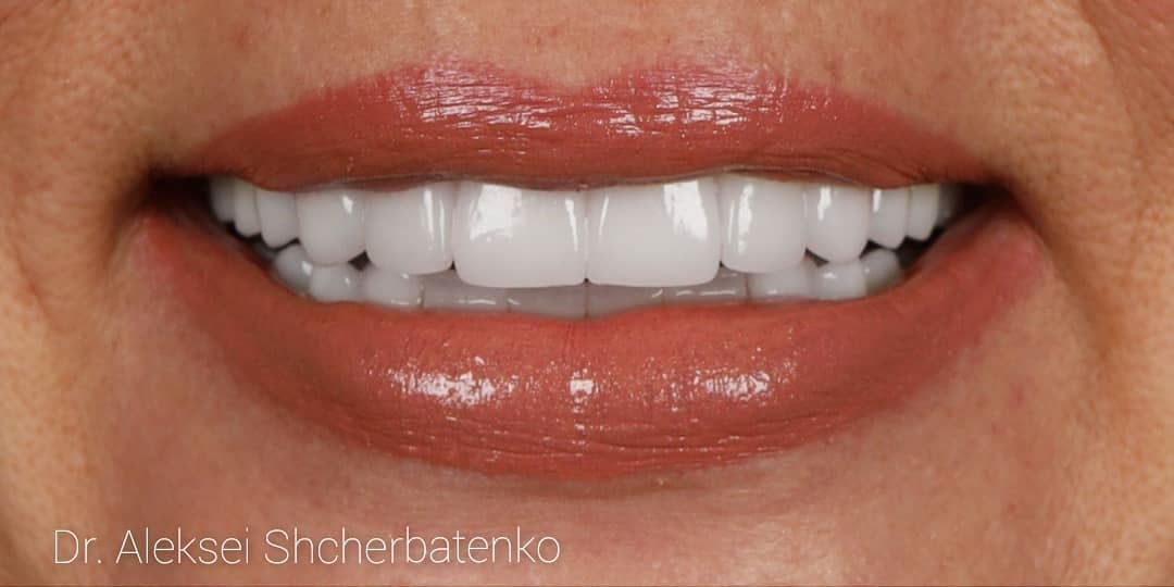 After-Dental-1