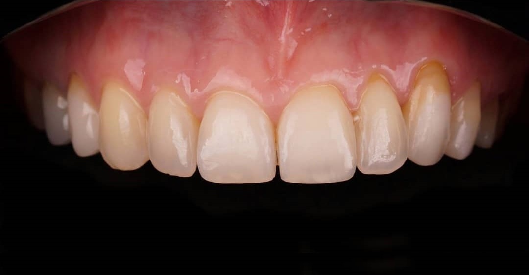 Before-Dental2