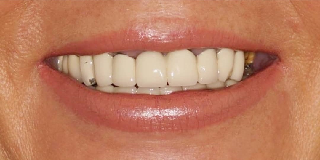 Before-Dental-1